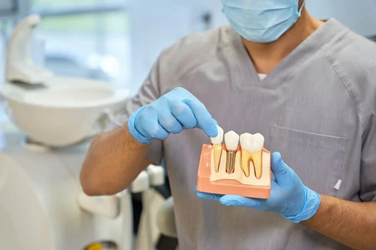 How Long Do Dental Implants Last?