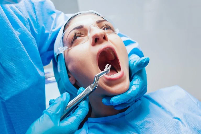 Dentist using surgical pliers to remove a decaying tooth