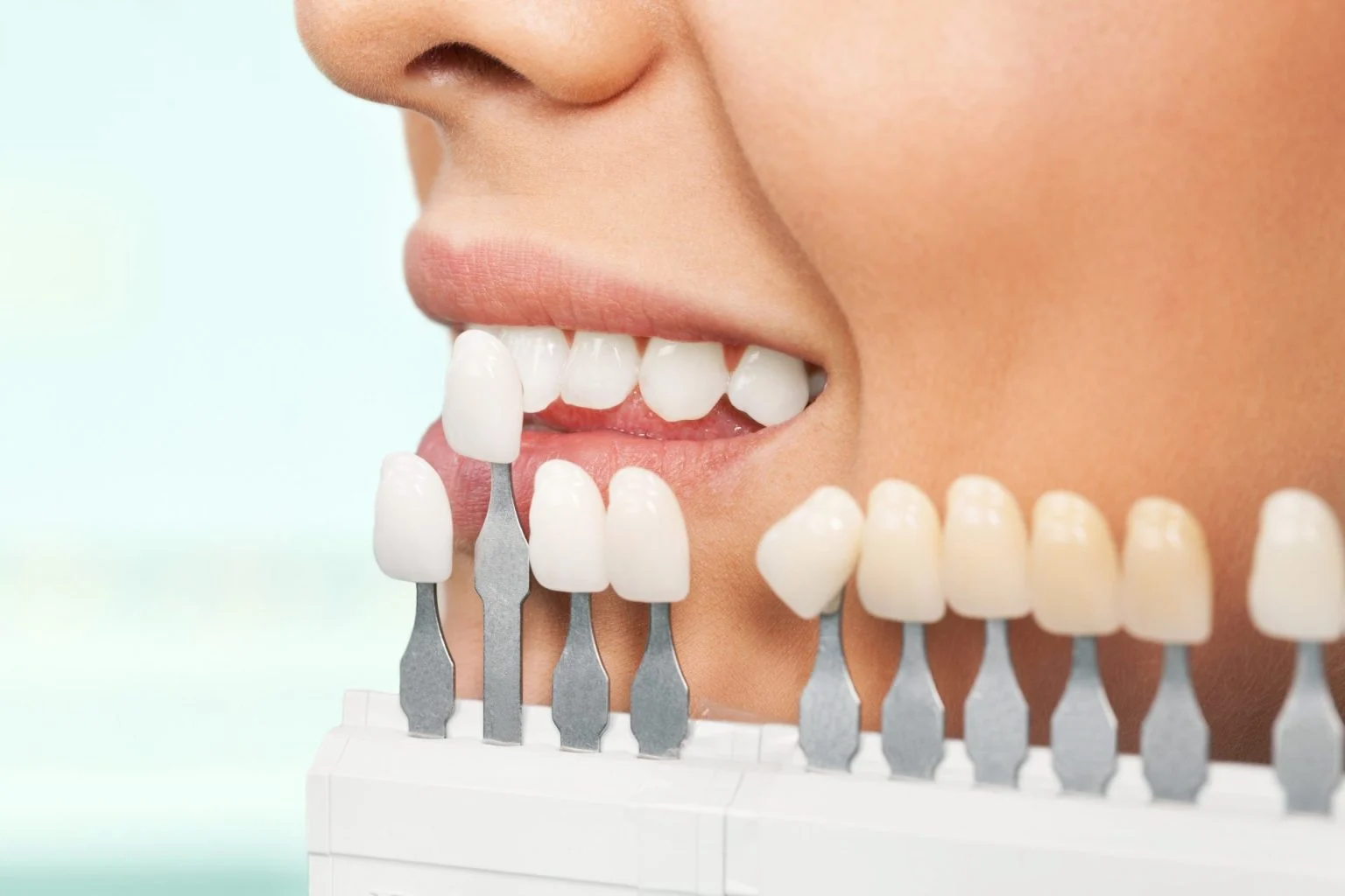 close up portrait young woman checking selecting color teeth 2