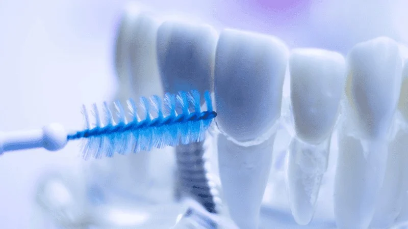 Special Tools and Techniques