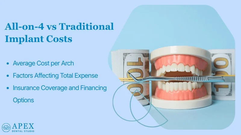 Cost Comparison All-on-4 vs Traditional Implants