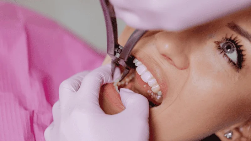 does tooth extraction hurt