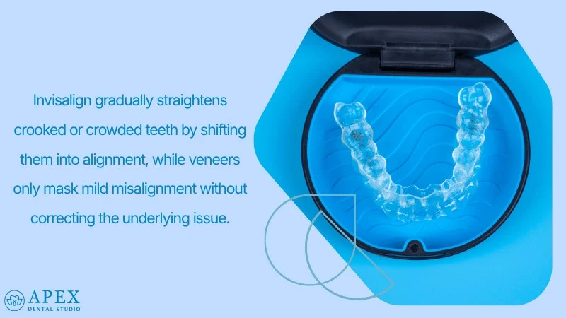 Straightening Crooked and Crowded Teeth