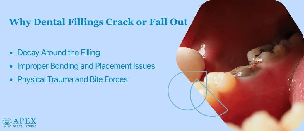 Main Causes of Fillings Cracking or Coming Loose