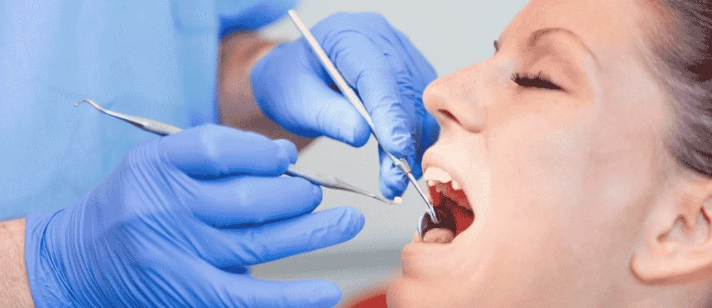 why do dental fillings keep falling out