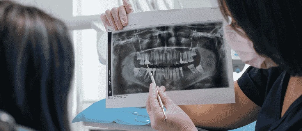 Questions to Ask Your Orthodontist