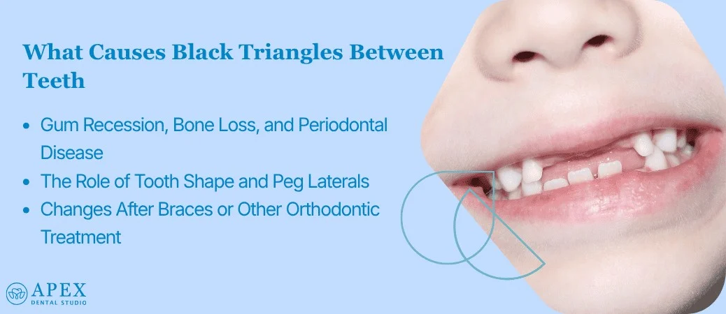 Why Black Triangles Develop