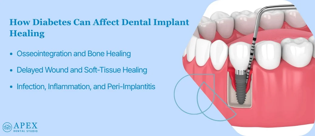 Why Diabetes Can Change Implant Healing