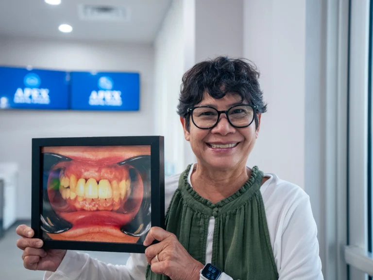 After Results Upper All on X Dental Implants Hutto TX