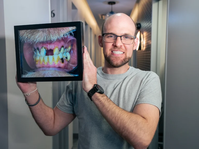 Results Full Mouth Rehab Hutto TX Apex Dental Studio